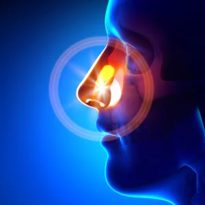 Is-a-Balloon-Sinuplasty-a-Solution-for-Me-300x300